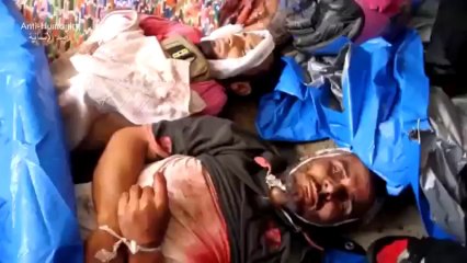 ضد الانسانية (الرقص على جثتى ) - YouTube