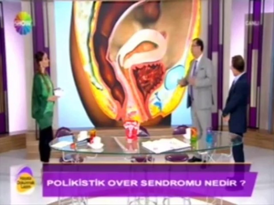 Prof. Dr. Bülent Tıraş, adet düzensizlikleri ve yumurtalık kistlerinin tedavisi part 1