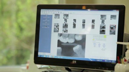 How safe are dental X-rays?