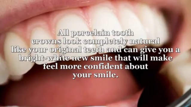 Tooth Crowns, Inlays, and Onlays | TheDCDentist.com