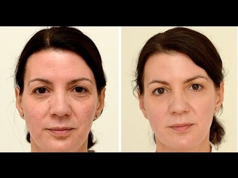 Drinking three liters of water a day gives you younger skin: study