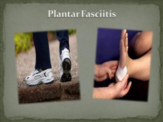 How To Find Heel Pain Treatment