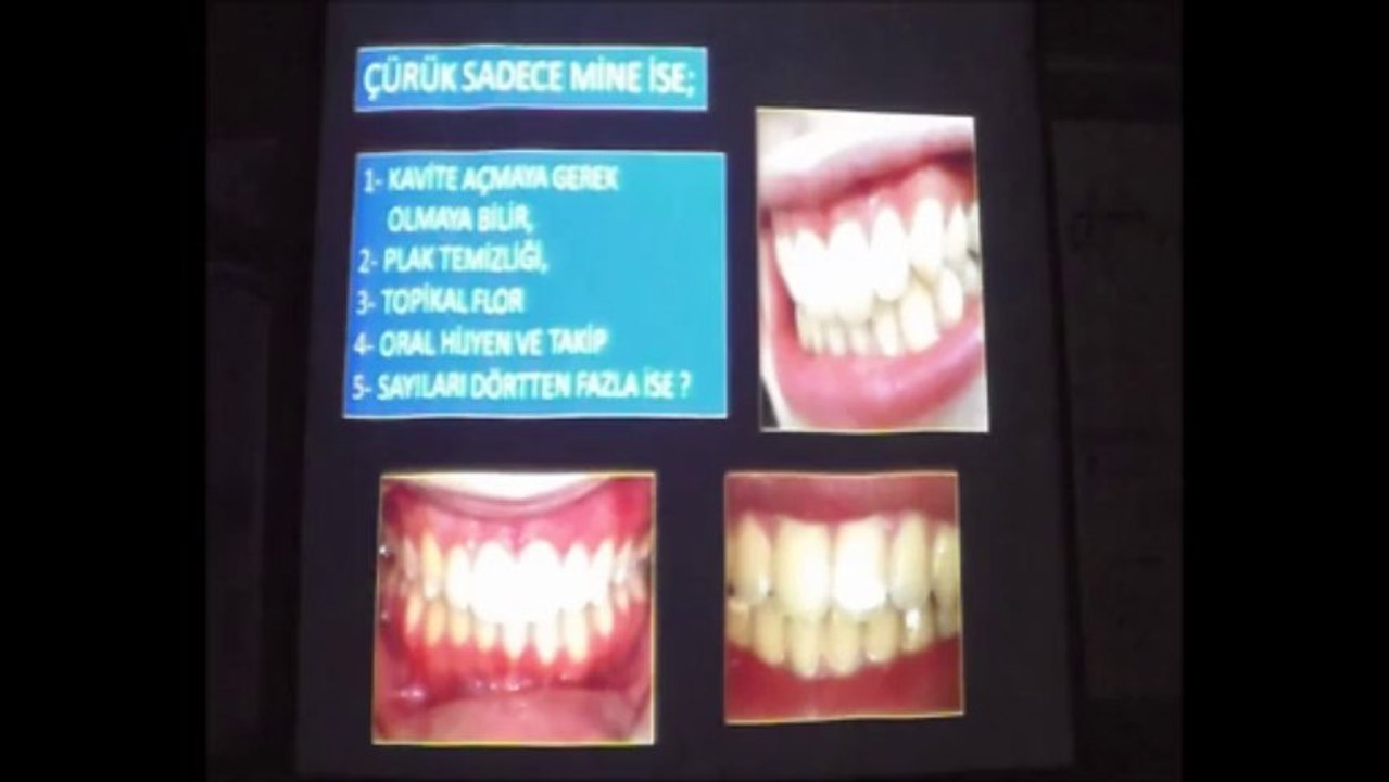 PROF.DR.YILDIRIM HAKAN BAĞIŞ 31 EKİM 2013 ADO EĞİTİM SEMİNERİ 1