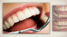 Sonoma Smiles Dental-Implants-Sebastopol, CA