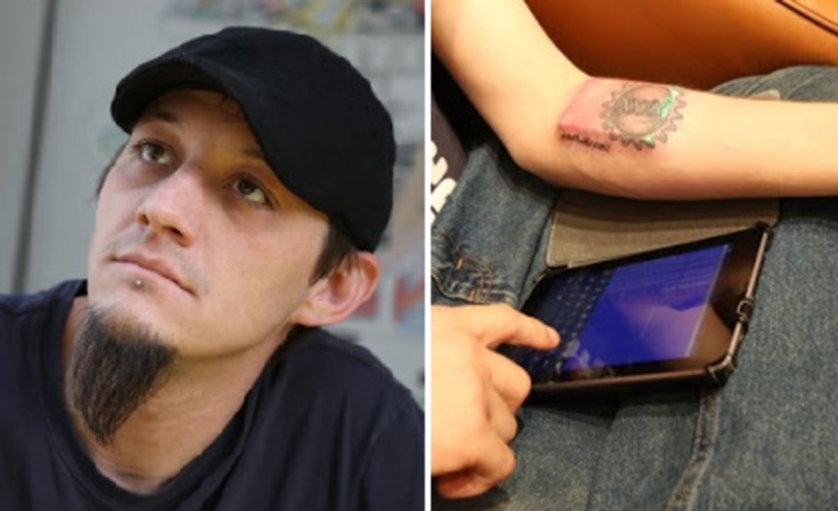 Man Designs And Implants DIY Computer Into His Forearm