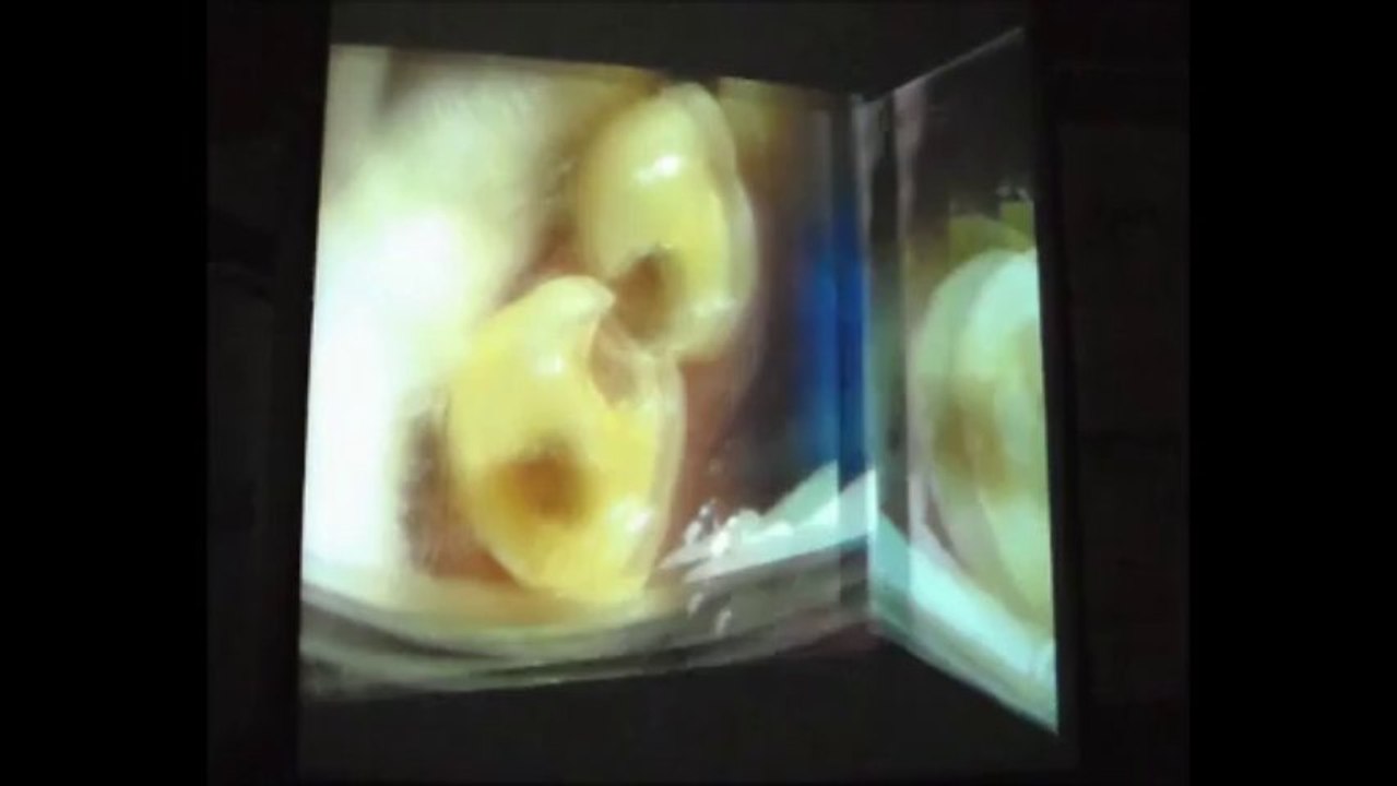 PROF.DR.YILDIRIM HAKAN BAĞIŞ 31 EKİM 2013 ADO EĞİTİM SEMİNERİ 2