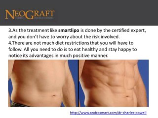 Advantages of Laser Lipo for Men