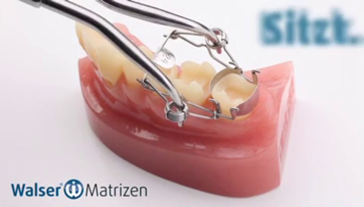 Walser® Teilmatrizen: Anwendung ON-Form Zahn Matrize