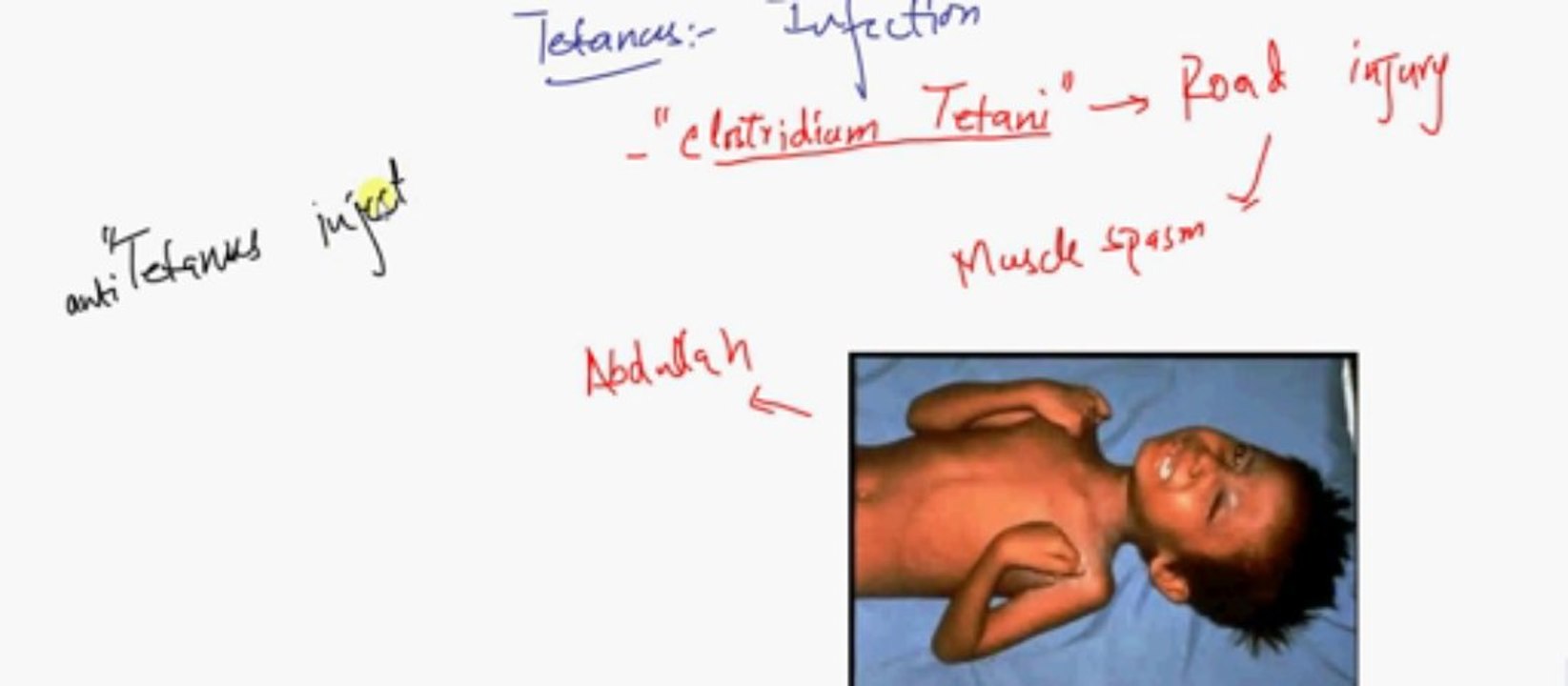 FSc Biology Book2, CH 14, LEC 14, Energy For Muscle Contraction and Muscle Problems