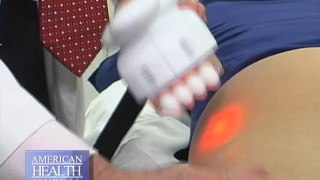 iLipo Ultra Treatment of Cellulite- Jon Perlman MD