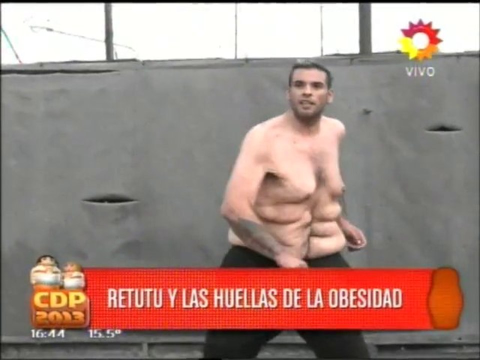 colgajos retutu