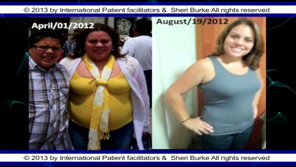 Weight loss patients before and after surgery