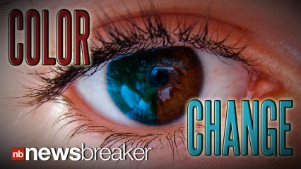 COLOR CHANGE: New Surgical Procedure to Change Eye Color