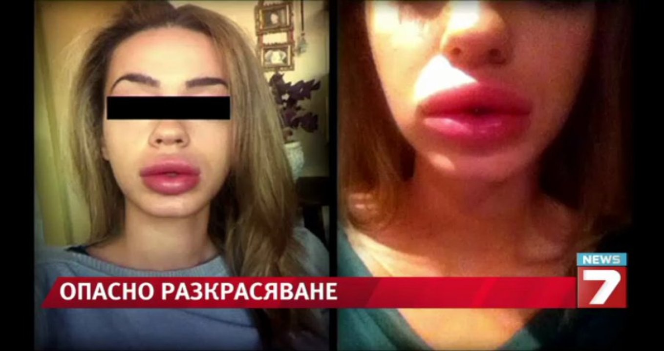Опасно разкрасяване / Самозванци правят опасни процедури с витамин Е