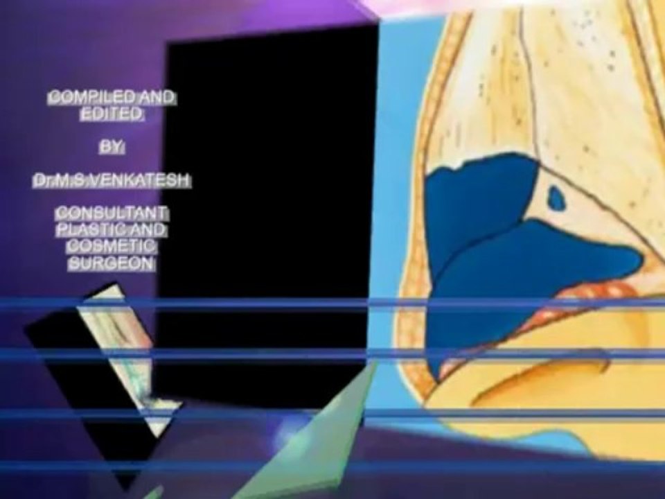 Rhinoplasty(Nose Job) at Bangalore, India,Happy confessions