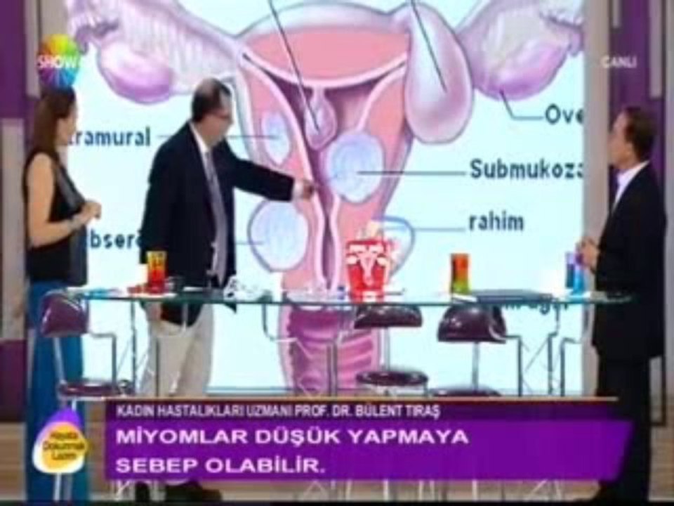 Prof. Dr. Bülent Tıraş miyomlar hakkında bilgi veriyo part 1