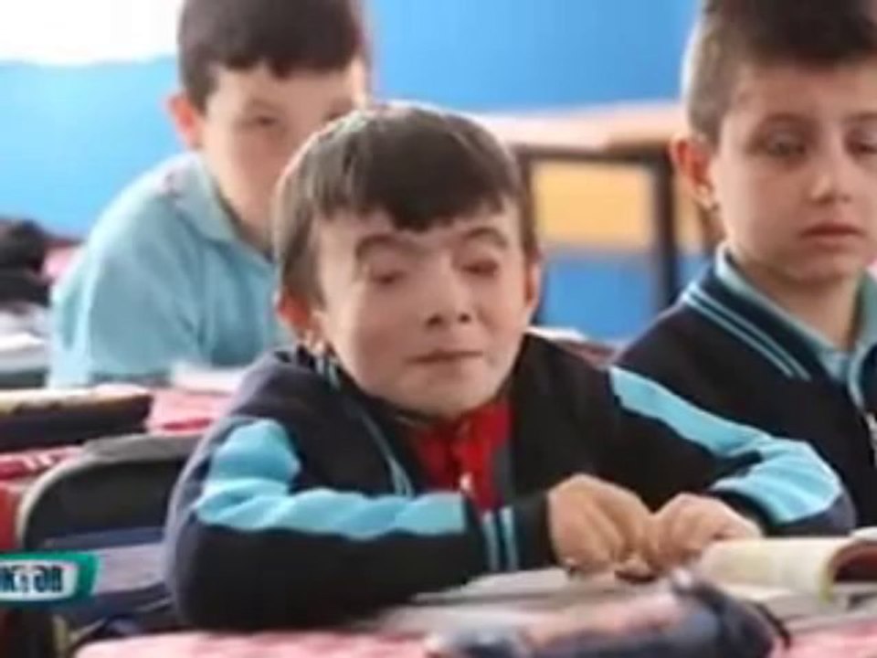 Prof. Dr. Müslime Akbaba göz kapağı tedavisi hakkında bilgi veriyor part 1