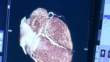 Flash Ct hangi amaçlarla kullanılır ?