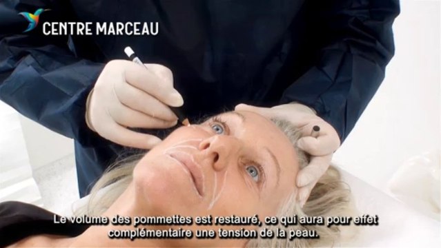 La Médecine Esthétique A Paris - l'Acide Hyaluronique