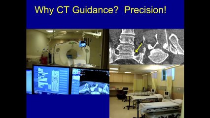 UCSF Radiology - A Peek Inside UCSF Precision Spine Center (PSC)