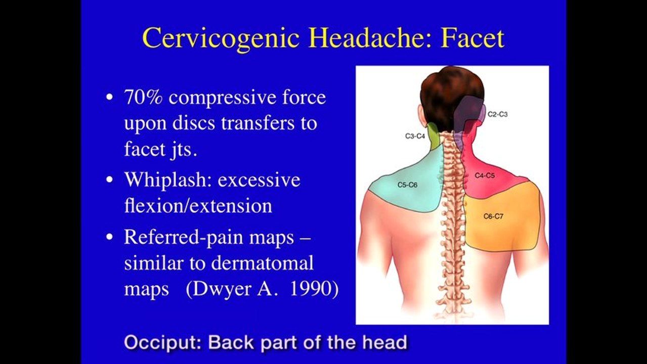 UCSF Radiology - Headache Pain