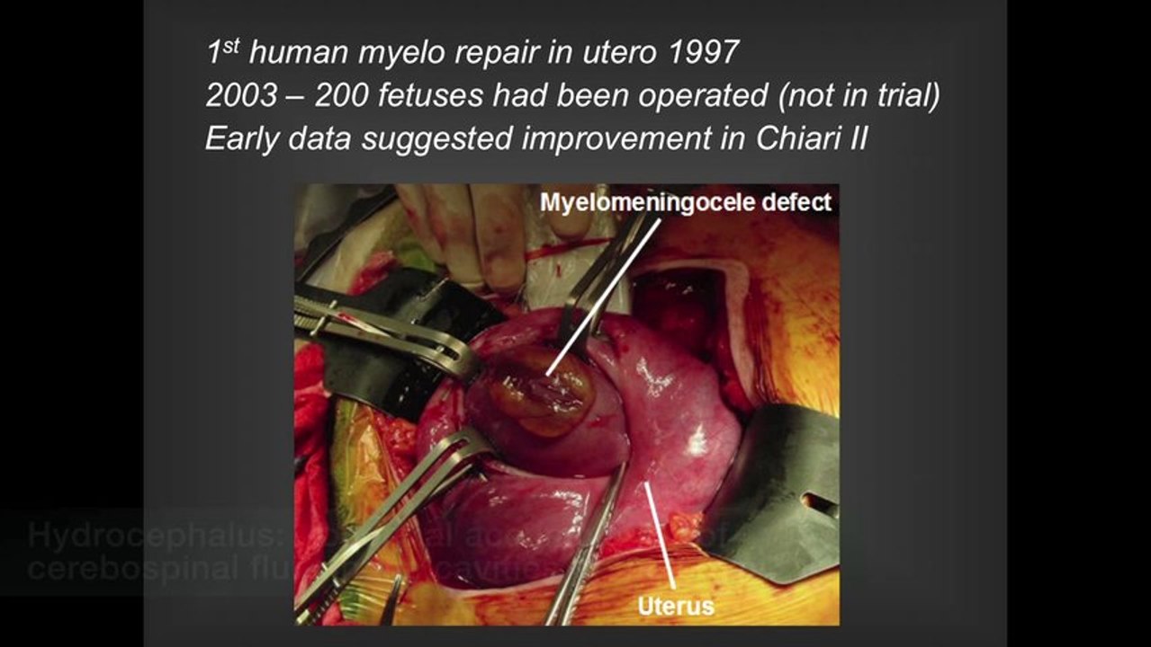 UCSF Radiology - Operating in the Womb