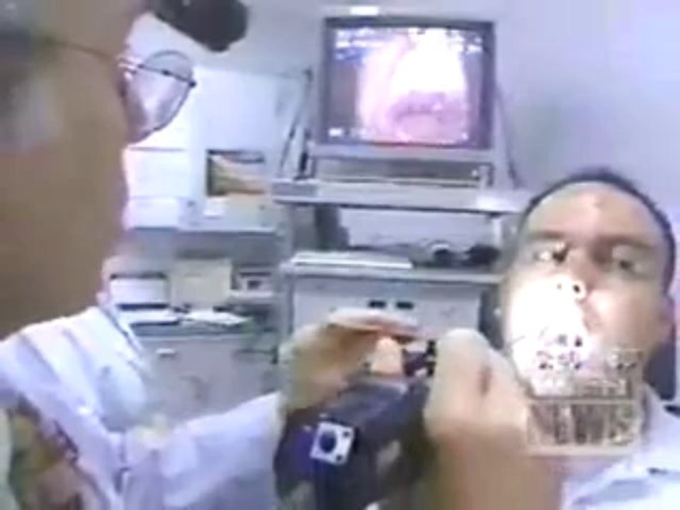 Non-Surgical Tonsillectomy - Sleep Apnea Center in Chicago