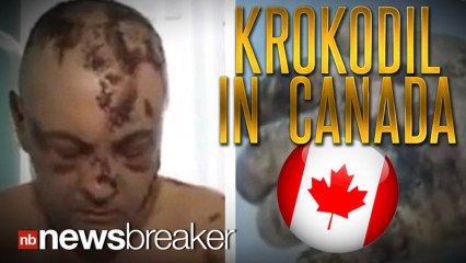 SPREADING: Flesh Eating Drug Krokodil Turns Up in Canada