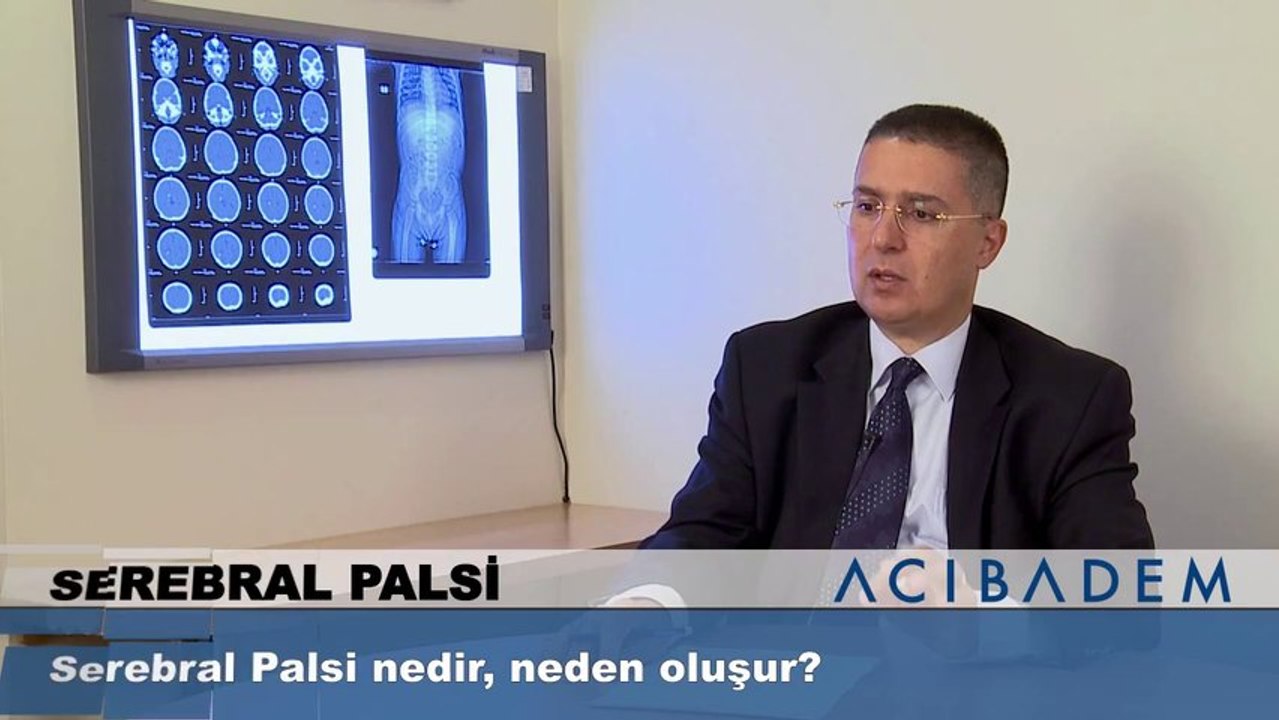 Serebral Palsi nedir, neden oluşur?