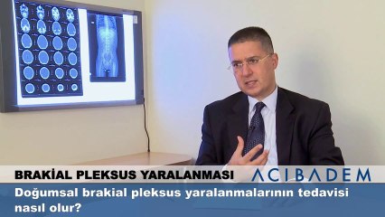 Doğumsal brakial pleksus yaralanmalarının tedavisi nasıl olur?