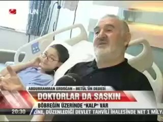 Böbrek nakli