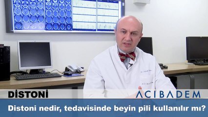 Distoni nedir tedavisinde beyin pili kullanılır mı?