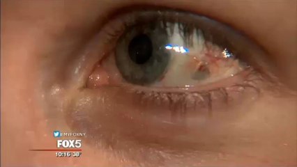 Bijoux implanté sur l'oeil