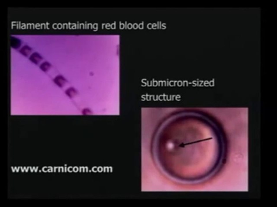 SECRET ZOMBIE CHEMTRAILS part 2