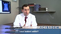 Mide kanaması nasıl tedavi edilir?