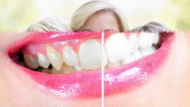 Emergency Dentist Milwaukee & Shorewood, WI - Dr. Frank R. Galka