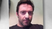 Hugh Jackman an Hautkrebs erkrankt