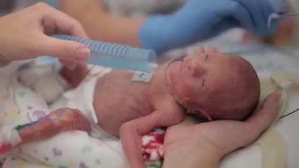 First Year of a cute baby, born way too early! Amazing