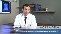 Hangi şikayetler mide kanamasının belirtisi olabilir?