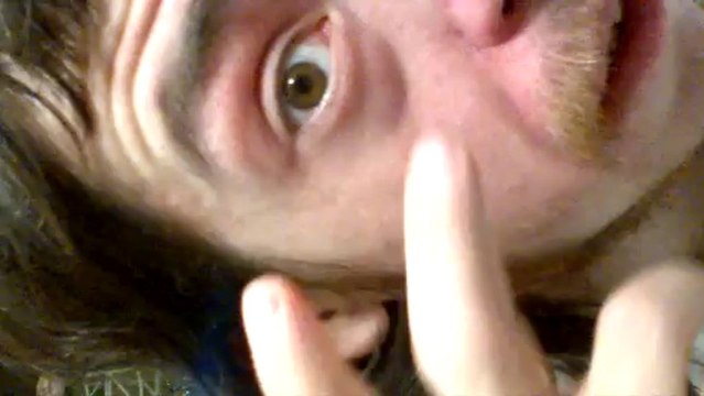 Popping some more zits on my nose, lip, that hurt like hell and stung like a bad bee sting