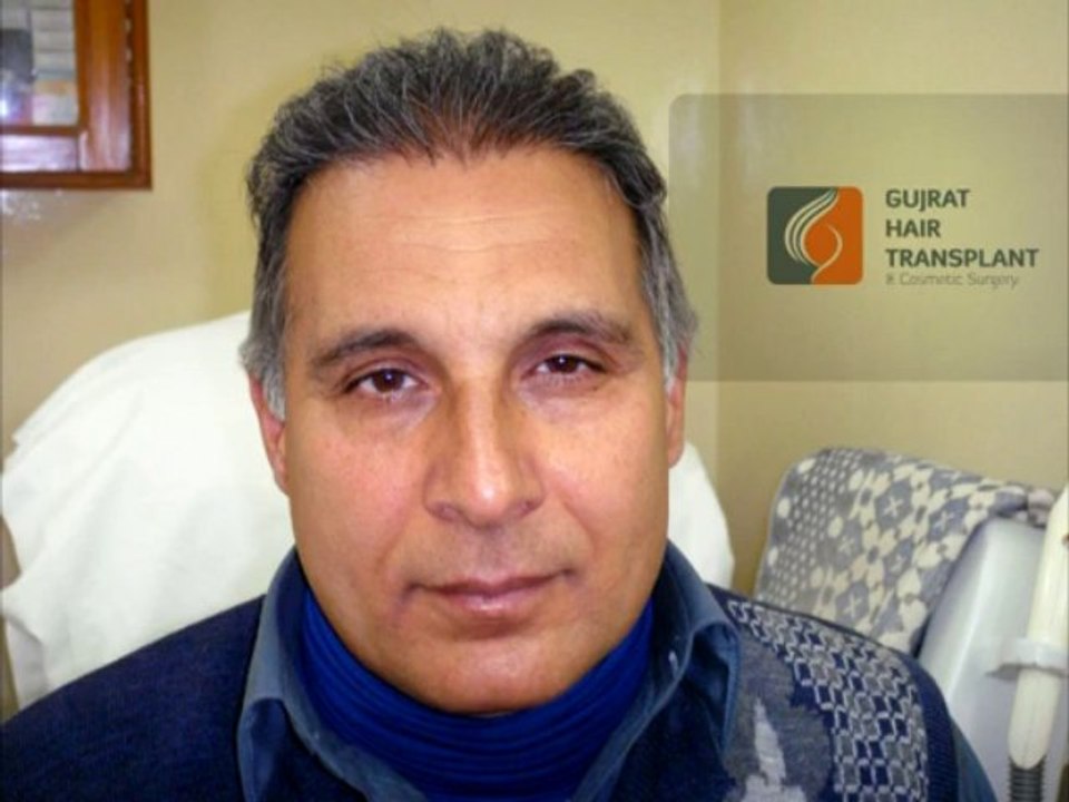 FUE hair transplant surgery,Gujrat Pakistan,www.fuepakistan