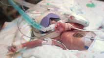 A emocionante história do bebé que nasceu com apenas 15 semanas