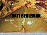 Tonik Hati Al Jabbar - Penawar Hati Kronik & Hepatitis