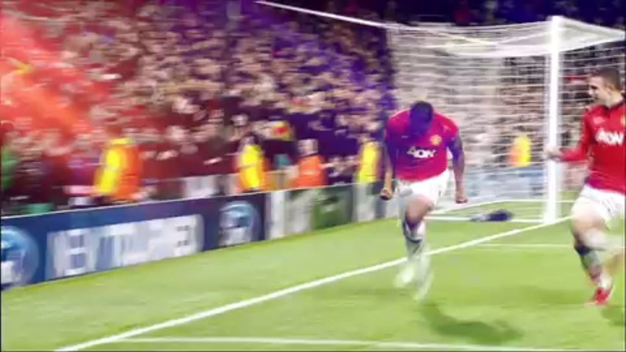 Bayer vs United: Zapowiedz