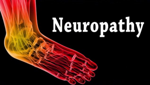 Podiatrist - Peripheral Neuropathy - DeBary, DeLand and Deltona, Fl