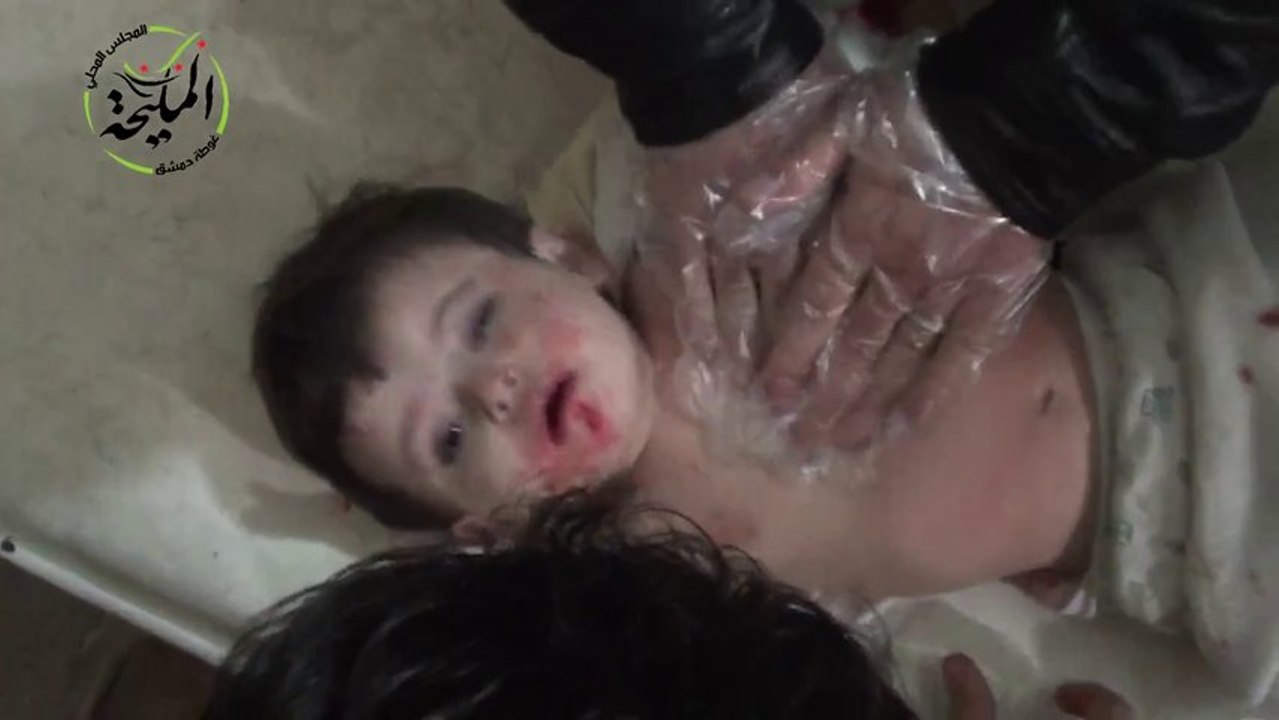 Baasın Bombaladığı Küçük Kız Çocuğu Ölüyor | Şam | Meliha | 27 11 13