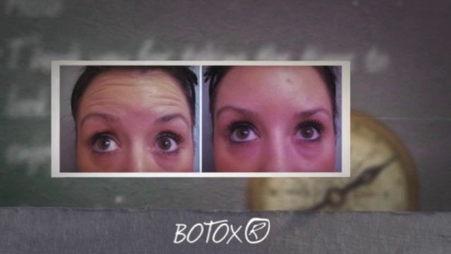 Chemical Peel Treatment Mesa AZ | Facial Resurfacing | (480) 832-7546