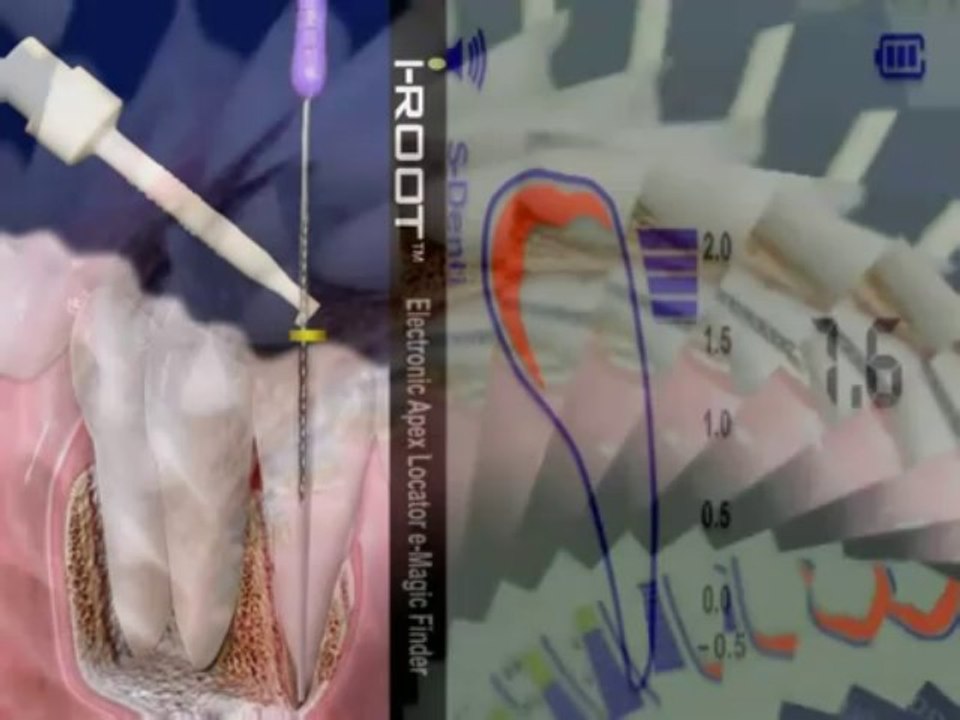 s-denti(영문)  Wevio Global Inc ™