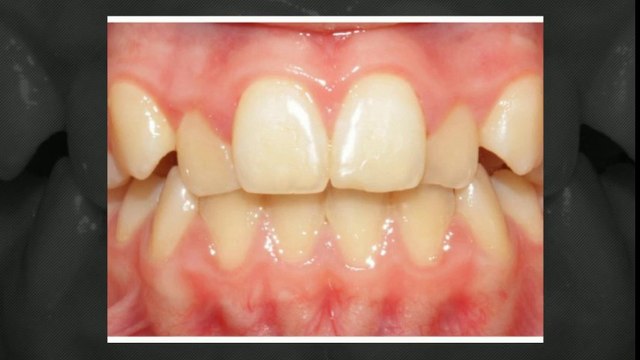 Dallas Orthodontists Nov2013