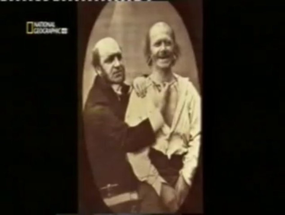 Cerebro mentiroso: Sonrisa de Duchenne
